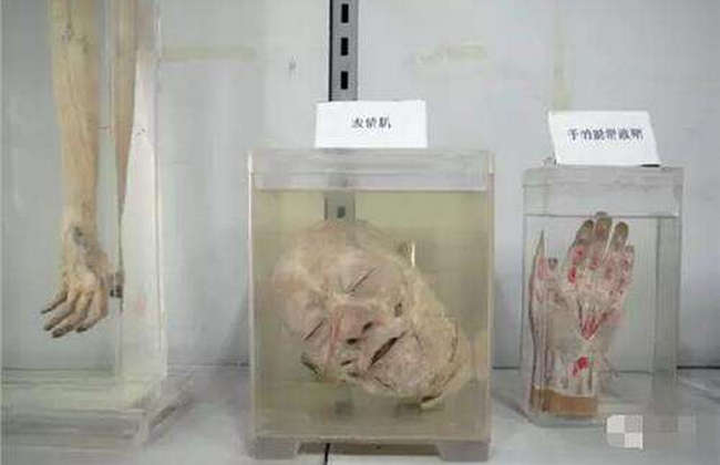 张伟杰事件