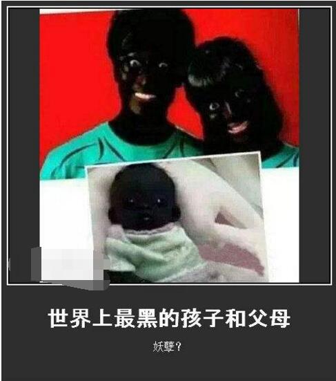世界上最黑的孩子，黑出人类新高度(真实性有待考证)